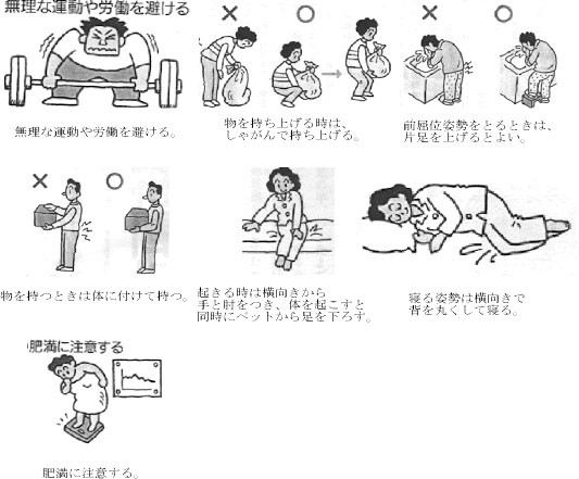 足関節捻挫 急性腰痛症 肩こり 芝山鍼灸整骨院が紹介する豆知識